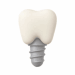 Dental Implant Specialists